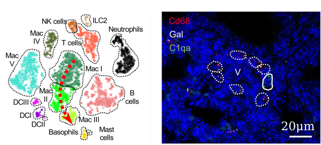 Neonatal lung immunity